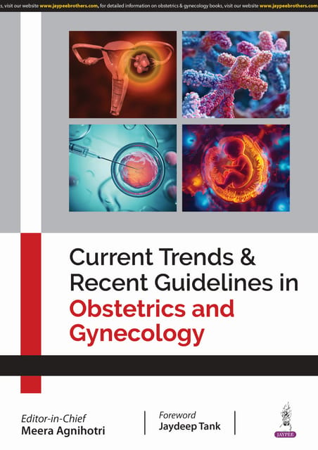 Current Trends & Recent Guidelines In Obstetrics And Gynecology 1st Edition 2025 By Meera Agnihotri