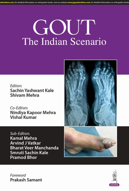 Gout The Indian Scenario 1st Edition 2025 By Sachin Yashwant Kale