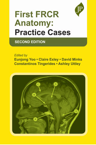 First Frcr Anatomy: Practice Cases 2nd Edition 2025 By Eunjong Yoo