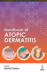 Handbook Of Atopic Dermatitis 1st Edition 2025 By Rashmi Sarkar