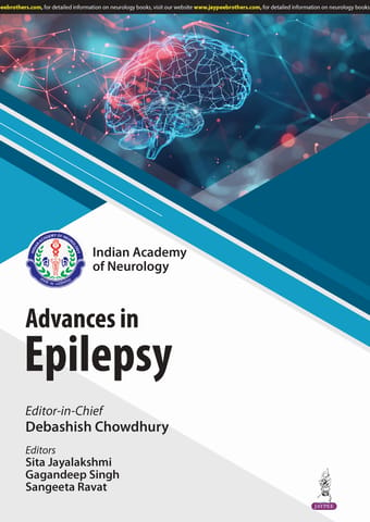 Ian Advances In Epilepsy 1st Edition 2025 By Debashish Chowdhury