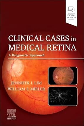 Clinical Cases In Medical Retina A Diagnostic Approach With Access Code 2025 By Lim J I