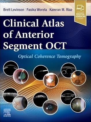 Clinical Atlas Of Anterior Segment Oct Optical Coherence Tomography With Access Code 2025 By Levinson B