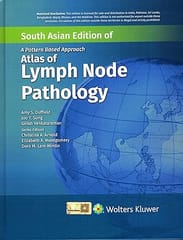 A Pattern Based Approach Atlas Of Lymph Node Pathology South Asia Edition 2024 By Duffield A S