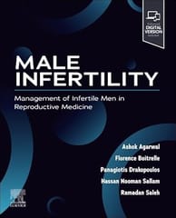 Male Infertility Management Of Infertile Men In Reproductive Medicine With Access Code 2025 By Agarwal A