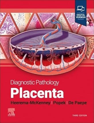 Diagnostic Pathology Placenta 3rd Edition 2024 By Heerema-Mckenney A