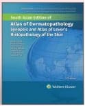 Atlas Of Dermatopathology Synopsis And Atlas Of Levers Histopathology Of The Skin 4th South Asia Edition 2024 By Elder D E