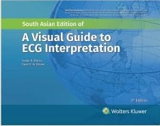 A Visual Guide to ECG Interpretation 3rd South Asia Edition 2025 By Susan Renee Wilcox