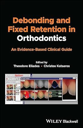 Debonding And Fixed Retention In Orthodontics An Evidence Based Clinical Guide 2023 By Eliades T