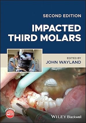 Impacted Third Molars 2nd Edition 2023 By Wayland J