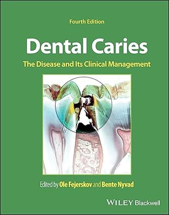 Dental Caries The Disease And Its Clinical Management 4th Edition 2025 By Fejerskov O