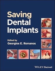 Saving Dental Implants 2024 By Romanos G E