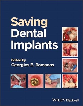 Saving Dental Implants 2024 By Romanos G E