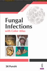 Fungal Infections With Color Altas 1st Edition 2024 By Sk Punshi