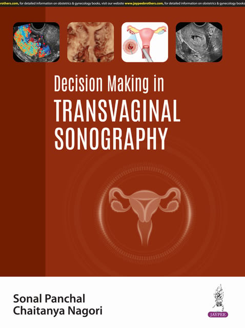 Decision Making In Transvaginal Sonography 1st Edition 2025 By Sonal Panchal