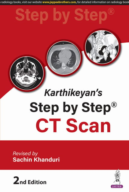 Karthikeyan'S Step By Step CT Scan 2nd Edition 2025 By Sachin Khanduri