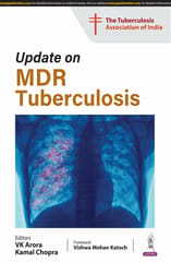 Update On Mdr Tuberculosis 2025 By VK Arora