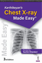 Karthikeyan'S Chest X-Ray Made Easy 2025 By Sachin Khanduri