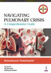 Navigating Pulmonary Crisis: A Comprehensive Guide 1st Edition 2025 By Mohankumar Thekkinkattil