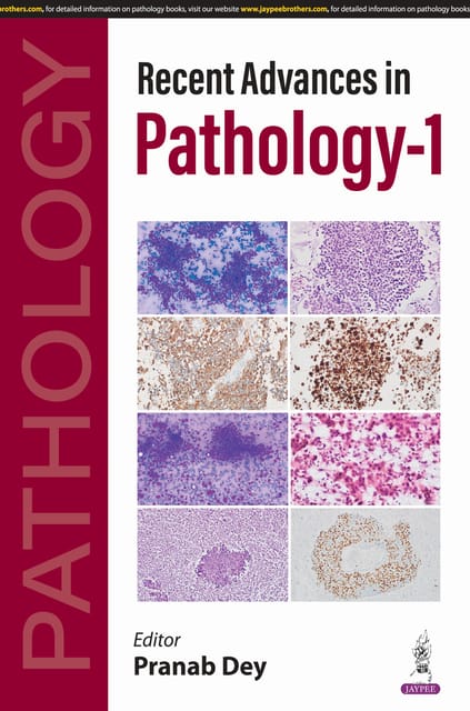 Recent Advances In Pathology-1 1st Edition 2025 By Pranab Dey