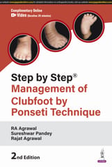 Step By Step Management Of Clubfoot By Ponseti Technique 2nd Edition 2025 By RA Agrawal