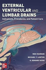 External Ventricular And Lumbar Drains Indications Procedures And Patient Care  2024 By Rahmani R