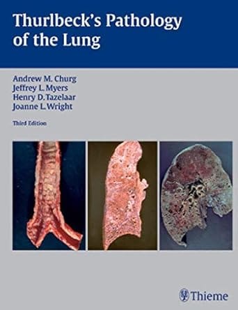 Thurlbeck'S Pathology Of The Lung 2005 By Churg A M