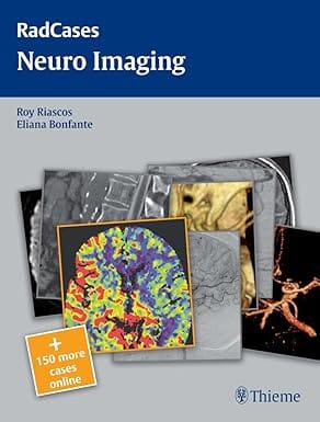 Radcases Neuro Imaging 2011 By Riascos