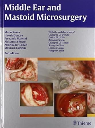 Middle Ear And Mastoid Microsurgery 2nd Edition 2012 By Sanna M