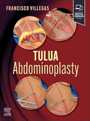 TULUA Abdominoplasty: Transverse Plication Technique 1st Editiion  2024 By Villegas-Alza