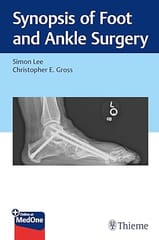 Synopsis of Foot and Ankle Surgery 1st Edition 2024 By Lee