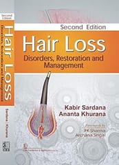 Hair Loss Disorders Restoration And Management 2nd Edition 2018 By Kabir Sardana