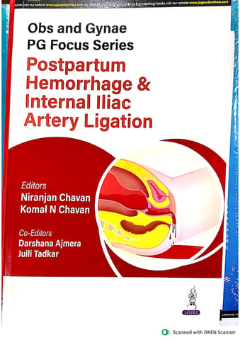 Obs And Gynae Pg Focus Series Postpartum Hemorrhage & Internal Iliac Artery Ligation 1st Edition 2025 By Niranjan Chavan