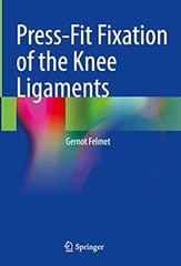 Press Fit Fixation Of The Knee Ligaments 2022 By Felmet G