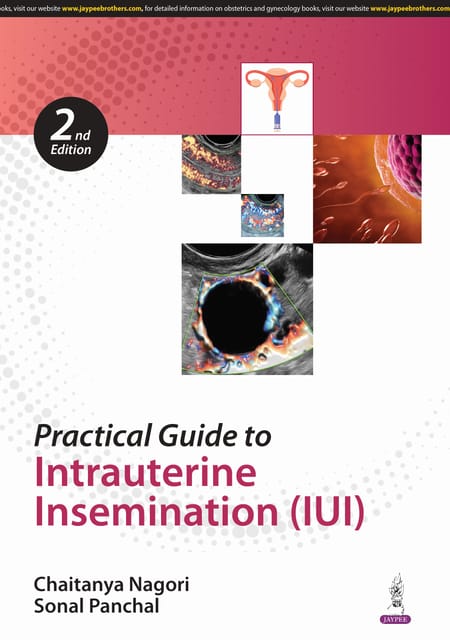 Practical Guide to Intrauterine Insemination 2nd Edition 2025 By Chaitanya Nagori