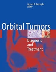 Orbital Tumors 2005 By Karcioglu Z A