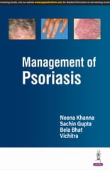 Management Of Psoriasis 1st Edition 2025 By Neena Khanna