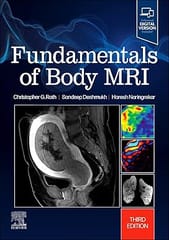 Fundamentals of Body MRI 3rd Edition 2024 By Christopher G Roth