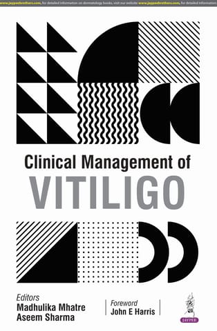 Clinical Management Of Vitiligo 1st Edition 2025 By Madhulika Mhatre