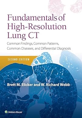 Fundamentals Of High Resolution Lung Ct Common Findings Common Patterns Common Diseases And Differential Diagnosis 2nd Edition 2019 By Elicker B M