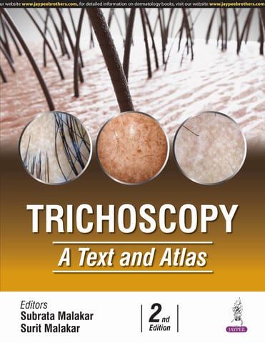 Trichoscopy A Text And Atlas 2nd Edition 2025 By Subrata Malakar