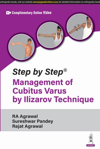 Step By Step Management Of Cubitus Varus By Ilizarove Technique 1st Edition 2025 By Ra Agrawal