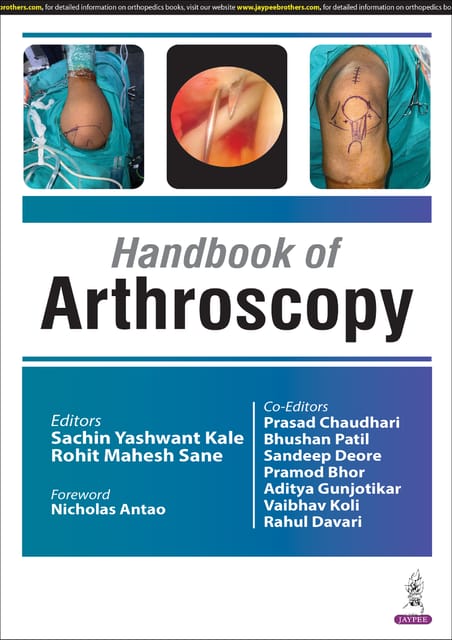 Handbook Of Arthoscopy 1st Edition 2025 By Sachin Yashwant Kale