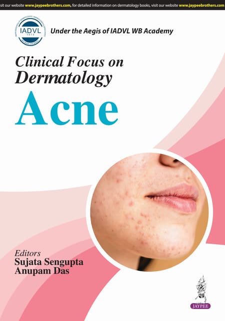 Clinical Focus On Dermatology Acne 1st Edition 2025 By Sujata Sengupta