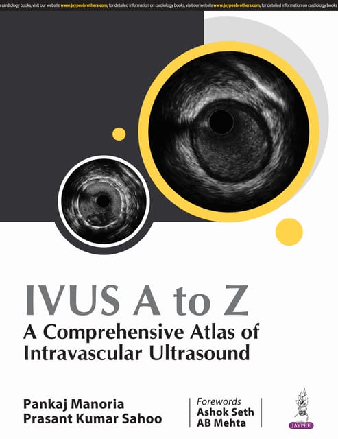 Ivus A To Z, A Comprehensive Atlas Of Intravascular Ultrasound 1st Edition 2025 By Pankaj Manoria