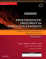 Prosthodontic Treatment for Edentulous Patients: Complete Dentures and Implant-Supported Prostheses 2017 by Zarb