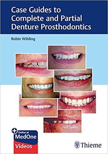 Case Guides to Complete and Partial Denture Prosthodontics 1st Edition 2020 By Robin Wilding